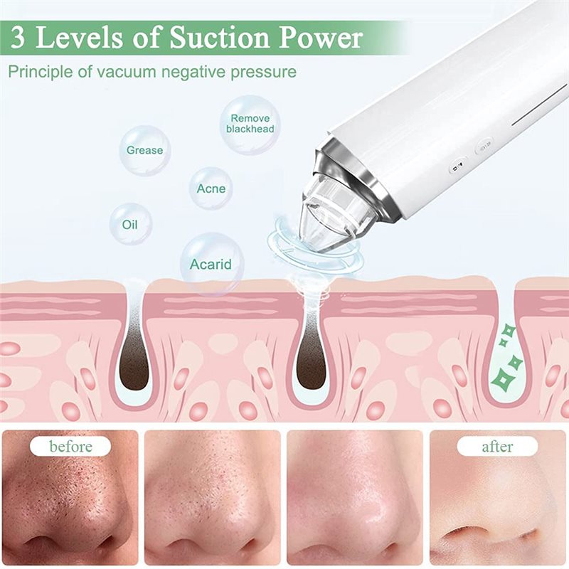 【FITTING】Blackhead Remover Por - đánh giá và giá Home Improvement Kit